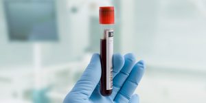 Krebs frühzeitig erkennen