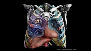 Künstliche Intelligenz im Kampf gegen den Krebs